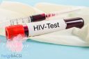 xét nghiệm hiv